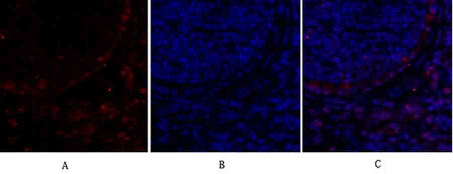 Fig.2. Immunofluorescence analysis of mouse lung tissue. 1, Rb Polyclonal Antibody (red) was diluted at 1:200 (4°C, overnight). 2, Cy3 Labeled secondary antibody was diluted at 1:300 (room temperature, 50min). 3, Picture B: DAPI (blue) 10min. Picture A: Target. Picture B: DAPI. Picture C: merge of A+B.