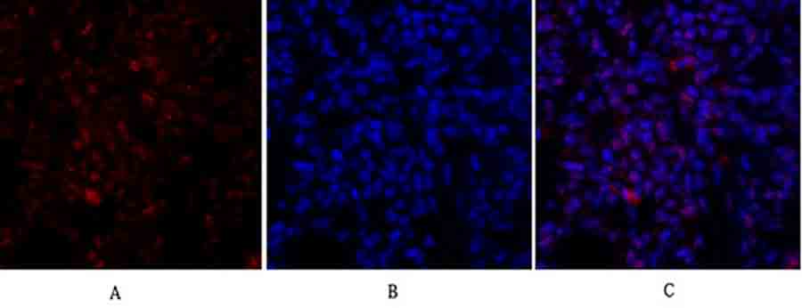 Fig.3. Immunofluorescence analysis of rat lung tissue. 1, Rb Polyclonal Antibody (red) was diluted at 1:200 (4°C, overnight). 2, Cy3 Labeled secondary antibody was diluted at 1:300 (room temperature, 50min). 3, Picture B: DAPI (blue) 10min. Picture A: Target. Picture B: DAPI. Picture C: merge of A+B.
