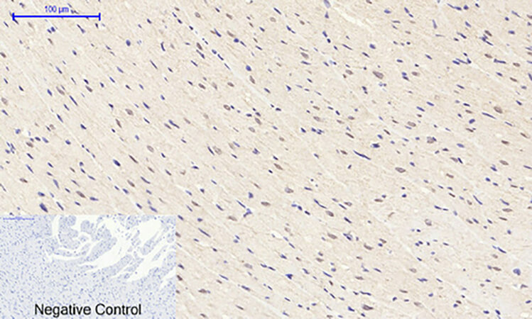 Fig.6. Immunohistochemical analysis of paraffin-embedded rat heart tissue. 1, Rb Polyclonal Antibody was diluted at 1:200 (4°C, overnight). 2, Sodium citrate pH 6.0 was used for antibody retrieval (>98°C, 20min). 3, secondary antibody was diluted at 1:200 (room temperature, 30min). Negative control was used by secondary antibody only.