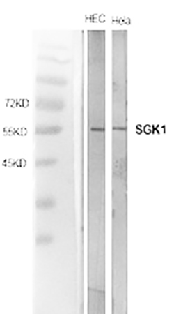 Fig.1. Western Blot analysis of HEC (1), Hela (2), diluted at 1:1000.