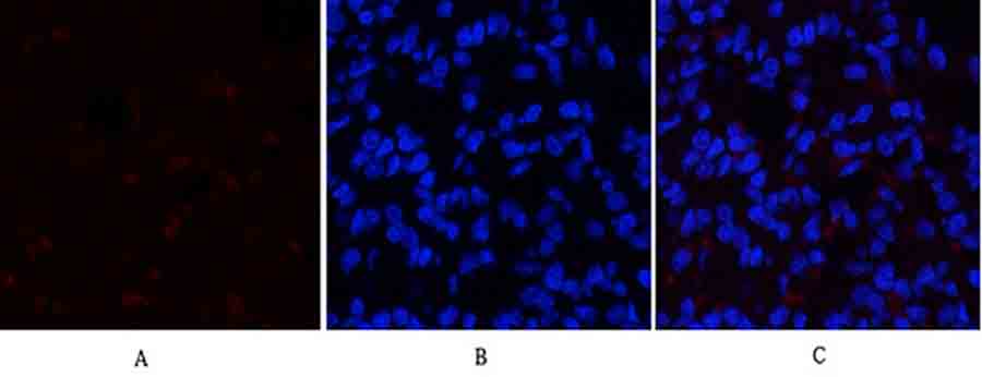 Fig.3. Immunofluorescence analysis of rat lung tissue. 1, SGK1 Polyclonal Antibody (red) was diluted at 1:200 (4°C, overnight). 2, Cy3 Labeled secondary antibody was diluted at 1:300 (room temperature, 50min). 3, Picture B: DAPI (blue) 10min. Picture A: Target. Picture B: DAPI. Picture C: merge of A+B.
