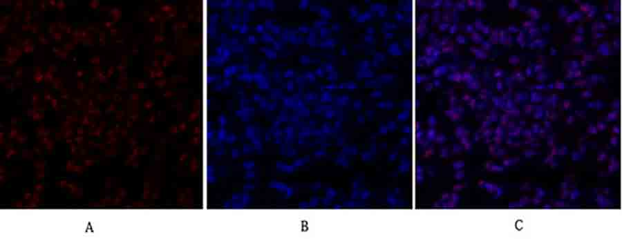 Fig.2. Immunofluorescence analysis of rat lung tissue. 1, SIRT1 Polyclonal Antibody (red) was diluted at 1:200 (4°C, overnight). 2, Cy3 Labeled secondary antibody was diluted at 1:300 (room temperature, 50min). 3, Picture B: DAPI (blue) 10min. Picture A: Target. Picture B: DAPI. Picture C: merge of A+B.
