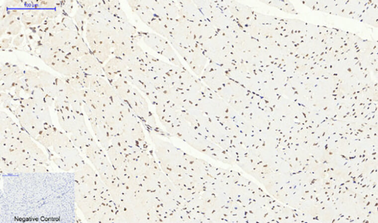 Fig.4. Immunohistochemical analysis of paraffin-embedded mouse heart tissue. 1, SIRT1 Polyclonal Antibody was diluted at 1:200 (4°C, overnight). 2, Sodium citrate pH 6.0 was used for antibody retrieval (>98°C, 20min). 3, secondary antibody was diluted at 1:200 (room temperature, 30min). Negative control was used by secondary antibody only.