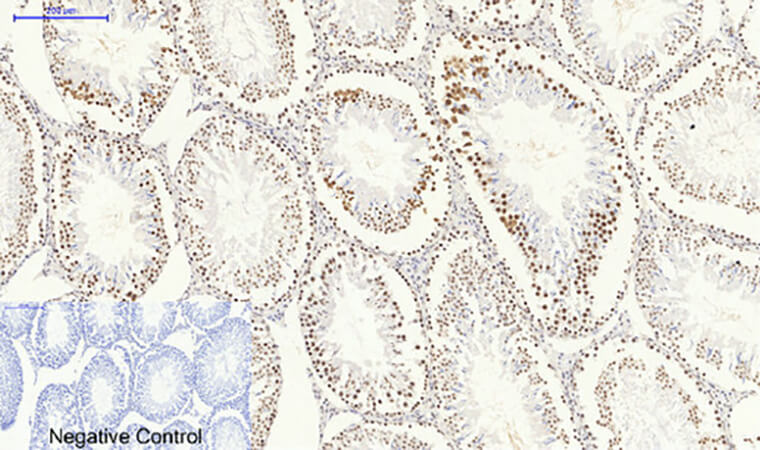 Fig.5. Immunohistochemical analysis of paraffin-embedded rat testis tissue. 1, SIRT1 Polyclonal Antibody was diluted at 1:200 (4°C, overnight). 2, Sodium citrate pH 6.0 was used for antibody retrieval (>98°C, 20min). 3, secondary antibody was diluted at 1:200 (room temperature, 30min). Negative control was used by secondary antibody only.