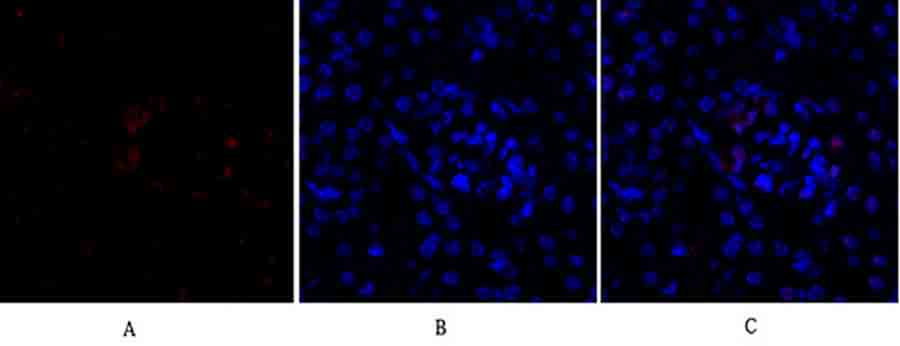 Fig.2. Immunofluorescence analysis of Mouse kidney tissue. 1,  Smad3 Polyclonal Antibody (red) was diluted at 1:200 (4°C, overnight). 2,  Cy3 Labeled secondary antibody was diluted at 1:300 (room temperature, 50min). 3, Picture B: DAPI (blue) 10min. Picture A: Target. Picture B: DAPI. Picture C: merge of A+B.