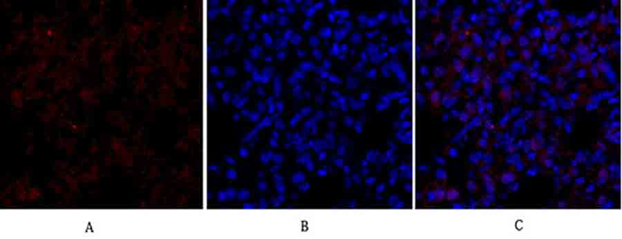 Fig.3. Immunofluorescence analysis of rat lung tissue. 1,  Smad3 Polyclonal Antibody (red) was diluted at 1:200 (4°C, overnight). 2,  Cy3 Labeled secondary antibody was diluted at 1:300 (room temperature, 50min). 3, Picture B: DAPI (blue) 10min. Picture A: Target. Picture B: DAPI. Picture C: merge of A+B.