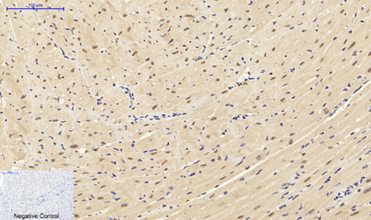 Fig.5. Immunohistochemical analysis of paraffin-embedded Mouse heart tissue. 1,  Smad3 Polyclonal Antibody was diluted at 1:200 (4°C, overnight). 2,  Sodium citrate pH 6.0 was used for antibody retrieval (>98°C, 20min). 3, secondary antibody was diluted at 1:200 (room temperature, 30min). Negative control was used by secondary antibody only.