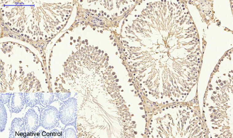 Fig.6. Immunohistochemical analysis of paraffin-embedded rat testis tissue. 1,  Smad3 Polyclonal Antibody was diluted at 1:200 (4°C, overnight). 2,  Sodium citrate pH 6.0 was used for antibody retrieval (>98°C, 20min). 3, secondary antibody was diluted at 1:200 (room temperature, 30min). Negative control was used by secondary antibody only.