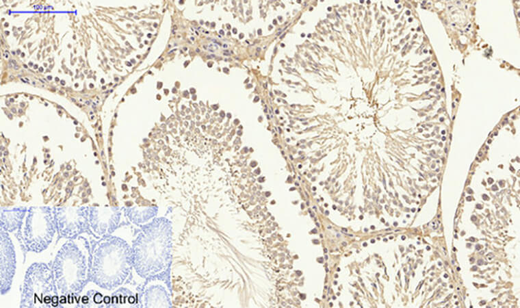 Fig.6. Immunohistochemical analysis of paraffin-embedded rat testis tissue. 1,  Smad3 Polyclonal Antibody was diluted at 1:200 (4°C, overnight). 2,  Sodium citrate pH 6.0 was used for antibody retrieval (>98°C, 20min). 3, secondary antibody was diluted at 1:200 (room temperature, 30min). Negative control was used by secondary antibody only.