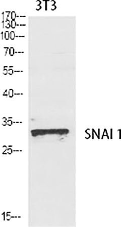 Fig.1. Western Blot analysis of various cells using SNAI 1 Polyclonal Antibody diluted at 1:1000.