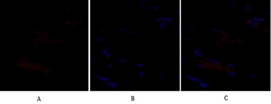 Fig.2. Immunofluorescence analysis of rat heart tissue. 1, SNAI 1 Polyclonal Antibody (red) was diluted at 1:200 (4°C, overnight). 2, Cy3 Labeled secondary antibody was diluted at 1:300 (room temperature, 50min). 3, Picture B: DAPI (blue) 10min. Picture A: Target. Picture B: DAPI. Picture C: merge of A+B.
