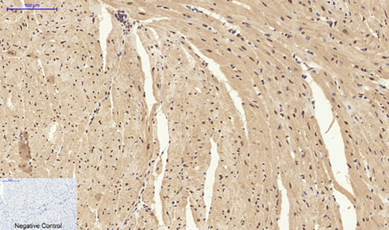 Fig.4. Immunohistochemical analysis of paraffin-embedded mouse heart tissue. 1, Stat1 Polyclonal Antibody was diluted at 1:200 (4°C, overnight). 2, Sodium citrate pH 6.0 was used for antibody retrieval (>98°C, 20min). 3, secondary antibody was diluted at 1:200 (room temperature, 30min). Negative control was used by secondary antibody only.