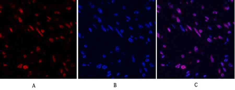 Fig.2. Immunofluorescence analysis of human uterus tissue. 1, Stat3 Polyclonal Antibody (red) was diluted at 1:200 (4°C, overnight). 2, Cy3 Labeled secondary antibody was diluted at 1:300 (room temperature, 50min). 3, Picture B: DAPI (blue) 10min. Picture A: Target. Picture B: DAPI. Picture C: merge of A+B.