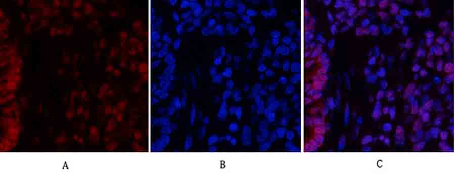 Fig.3. Immunofluorescence analysis of rat lung tissue. 1, Stat3 Polyclonal Antibody (red) was diluted at 1:200 (4°C, overnight). 2, Cy3 Labeled secondary antibody was diluted at 1:300 (room temperature, 50min). 3, Picture B: DAPI (blue) 10min. Picture A: Target. Picture B: DAPI. Picture C: merge of A+B.