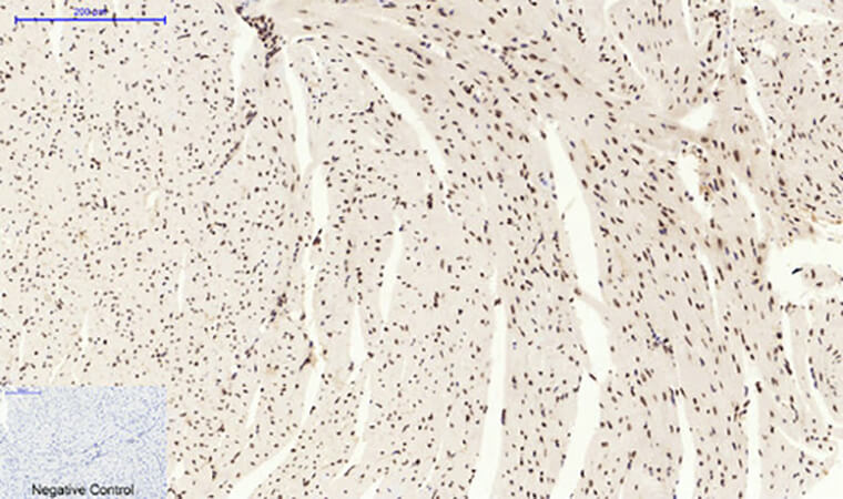 Fig.5. Immunohistochemical analysis of paraffin-embedded mouse heart tissue. 1, Stat3 Polyclonal Antibody was diluted at 1:200 (4°C, overnight). 2, Sodium citrate pH 6.0 was used for antibody retrieval (>98°C, 20min). 3, secondary antibody was diluted at 1:200 (room temperature, 30min). Negative control was used by secondary antibody only.