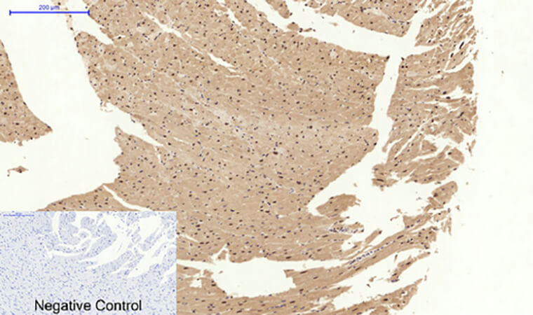 Fig.6. Immunohistochemical analysis of paraffin-embedded rat heart tissue. 1, Stat3 Polyclonal Antibody was diluted at 1:200 (4°C, overnight). 2, Sodium citrate pH 6.0 was used for antibody retrieval (>98°C, 20min). 3, secondary antibody was diluted at 1:200 (room temperature, 30min). Negative control was used by secondary antibody only.