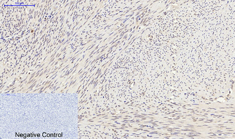 Fig.3. Immunohistochemical analysis of paraffin-embedded human uterus tissue. 1, Synapsin I Polyclonal Antibody was diluted at 1:200 (4°C, overnight). 2, Sodium citrate pH 6.0 was used for antibody retrieval (>98°C, 20min). 3, secondary antibody was diluted at 1:200 (room temperature, 30min). Negative control was used by secondary antibody only.