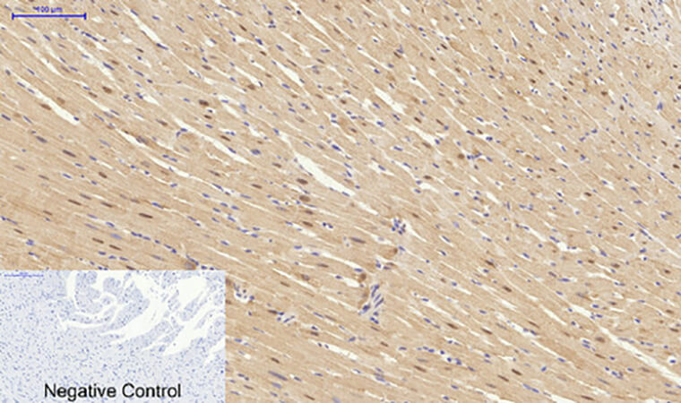 Fig.5. Immunohistochemical analysis of paraffin-embedded rat heart tissue. 1, Synapsin I Polyclonal Antibody was diluted at 1:200 (4°C, overnight). 2, Sodium citrate pH 6.0 was used for antibody retrieval (>98°C, 20min). 3, secondary antibody was diluted at 1:200 (room temperature, 30min). Negative control was used by secondary antibody only.