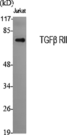 Fig.1. Western Blot analysis of various cells using TGFβ RII Polyclonal Antibody diluted at 1:2000.