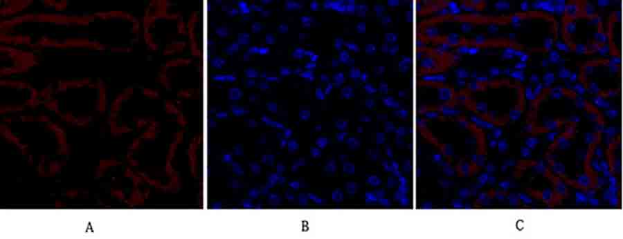 Fig.2. Immunofluorescence analysis of mouse kidney tissue. 1, TGFβ RII Polyclonal Antibody (red) was diluted at 1:200 (4°C, overnight). 2, Cy3 Labeled secondary antibody was diluted at 1:300 (room temperature, 50min). 3, Picture B: DAPI (blue) 10min. Picture A: Target. Picture B: DAPI. Picture C: merge of A+B.