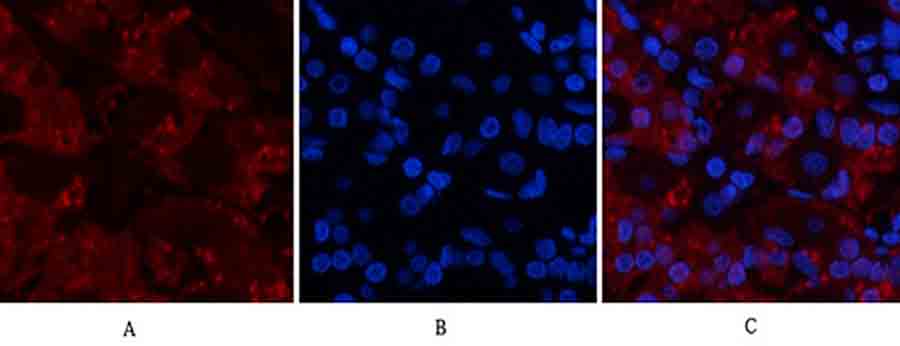Fig.2. Immunofluorescence analysis of human stomach tissue. 1, TNF-α Polyclonal Antibody (red) was diluted at 1:200 (4°C, overnight). 2, Cy3 Labeled secondary antibody was diluted at 1:300 (room temperature, 50min). 3, Picture B: DAPI (blue) 10min. Picture A: Target. Picture B: DAPI. Picture C: merge of A+B.