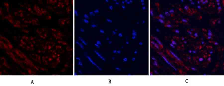 Fig.2. Immunofluorescence analysis of human uterus tissue. 1, Tubulin β Polyclonal Antibody (red) was diluted at 1:200 (4°C, overnight). 2, Cy3 Labeled secondary antibody was diluted at 1:300 (room temperature, 50min). 3, Picture B: DAPI (blue) 10min. Picture A: Target. Picture B: DAPI. Picture C: merge of A+B.