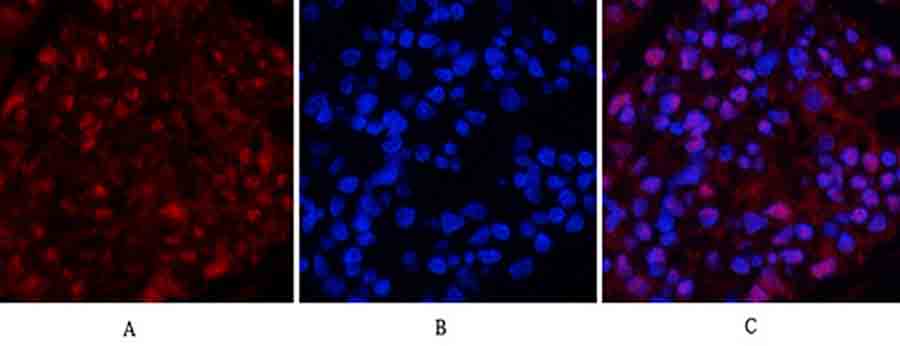 Fig.3. Immunofluorescence analysis of rat kidney tissue. 1, Tubulin β Polyclonal Antibody (red) was diluted at 1:200 (4°C, overnight). 2, Cy3 Labeled secondary antibody was diluted at 1:300 (room temperature, 50min). 3, Picture B: DAPI (blue) 10min. Picture A: Target. Picture B: DAPI. Picture C: merge of A+B.