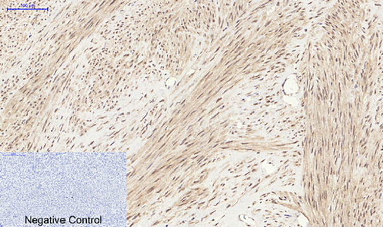 Fig.3. Immunohistochemical analysis of paraffin-embedded human uterus tissue. 1, YAP Polyclonal Antibody was diluted at 1:200 (4°C, overnight). 2, Sodium citrate pH 6.0 was used for antibody retrieval (>98°C, 20min). 3, secondary antibody was diluted at 1:200 (room temperature, 30min). Negative control was used by secondary antibody only.