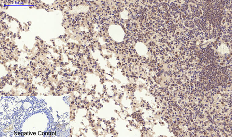 Fig.4. Immunohistochemical analysis of paraffin-embedded mouse lung tissue. 1, YAP Polyclonal Antibody was diluted at 1:200 (4°C, overnight). 2, Sodium citrate pH 6.0 was used for antibody retrieval (>98°C, 20min). 3, secondary antibody was diluted at 1:200 (room temperature, 30min). Negative control was used by secondary antibody only.