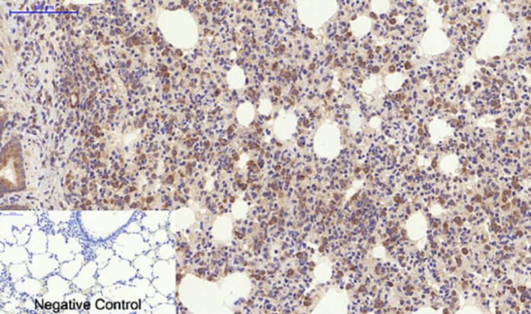 Fig.5. Immunohistochemical analysis of paraffin-embedded rat lung tissue. 1, YAP Polyclonal Antibody was diluted at 1:200 (4°C, overnight). 2, Sodium citrate pH 6.0 was used for antibody retrieval (>98°C, 20min). 3, secondary antibody was diluted at 1:200 (room temperature, 30min). Negative control was used by secondary antibody only.