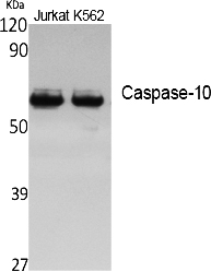 Fig. Western Blot analysis of extracts from Jurkat, K562 cells, using Caspase-10 Polyclonal Antibody. Secondary antibody (catalog#: A21020) was diluted at 1:20000.