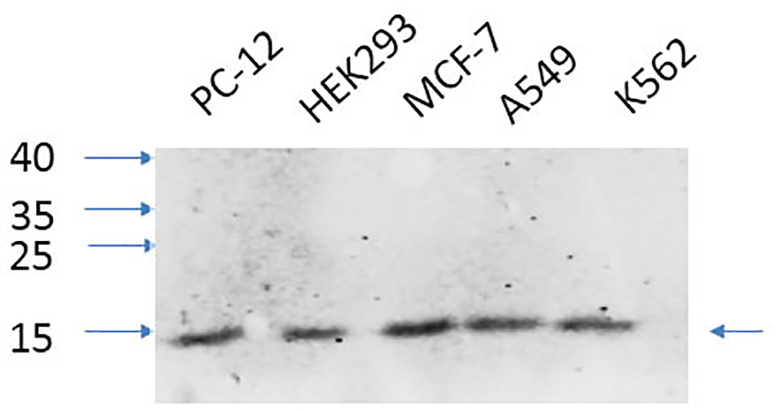 Fig.3. Western Blot analysis of PC-12 (1), HEK293 (2), MCF-7 (3), A549 (4), K562 (5), diluted at 1:1000.