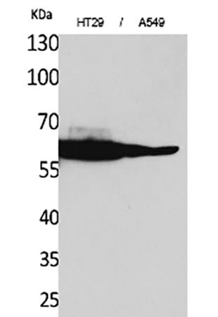 Fig.1. Western Blot analysis of HT29 (1), A549 (2), diluted at 1:1000.