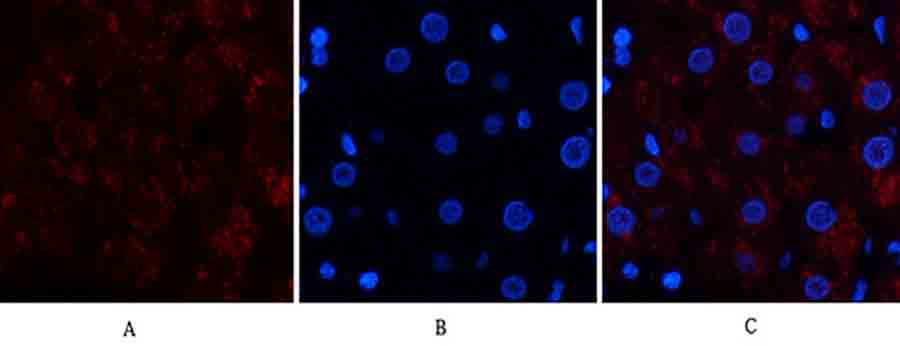 Fig.2. Immunofluorescence analysis of human liver tissue. 1, Catalase Polyclonal Antibody (red) was diluted at 1:200 (4°C, overnight). 2, Cy3 Labeled secondary antibody was diluted at 1:300 (room temperature, 50min). 3, Picture B: DAPI (blue) 10min. Picture A: Target. Picture B: DAPI. Picture C: merge of A+B.