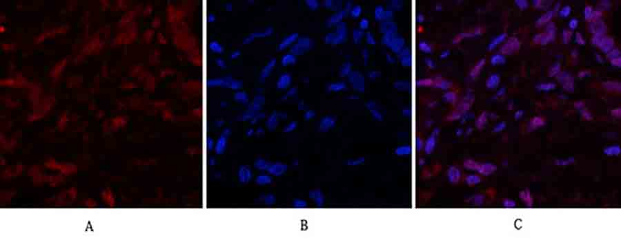 Fig.1. Immunofluorescence analysis of human lung tissue. 1, Caspase-3 Polyclonal Antibody (red) was diluted at 1:200 (4°C, overnight). 2, Cy3 Labeled secondary antibody was diluted at 1:300 (room temperature, 50min). 3, Picture B: DAPI (blue) 10min. Picture A: Target. Picture B: DAPI. Picture C: merge of A+B.