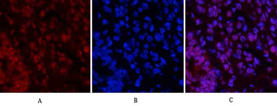 Fig.2. Immunofluorescence analysis of rat lung tissue. 1, Caspase-3 Polyclonal Antibody (red) was diluted at 1:200 (4°C, overnight). 2, Cy3 Labeled secondary antibody was diluted at 1:300 (room temperature, 50min). 3, Picture B: DAPI (blue) 10min. Picture A: Target. Picture B: DAPI. Picture C: merge of A+B.
