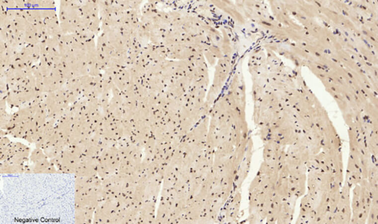 Fig.4. Immunohistochemical analysis of paraffin-embedded mouse heart tissue. 1, Caspase-3 Polyclonal Antibody was diluted at 1:200 (4°C, overnight). 2, Sodium citrate pH 6.0 was used for antibody retrieval (>98°C, 20min). 3, secondary antibody was diluted at 1:200 (room temperature, 30min). Negative control was used by secondary antibody only.