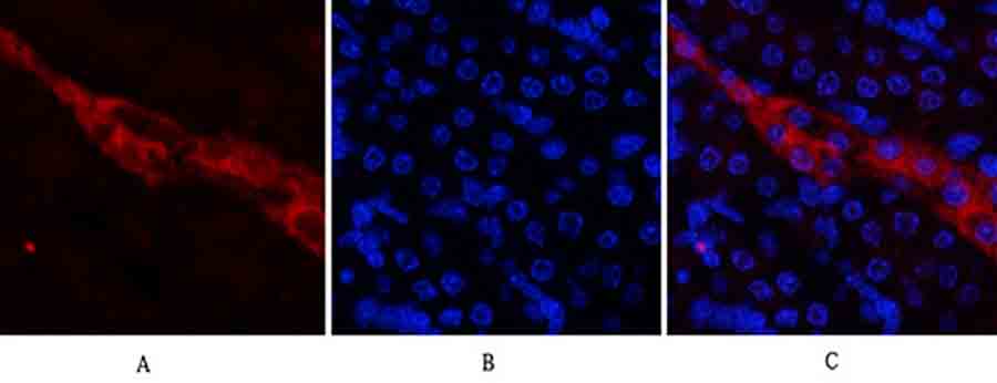 Fig.2. Immunofluorescence analysis of mouse kidney tissue. 1, CD81 Polyclonal Antibody (red) was diluted at 1:200 (4°C, overnight). 2, Cy3 Labeled secondary antibody was diluted at 1:300 (room temperature, 50min). 3, Picture B: DAPI (blue) 10min. Picture A: Target. Picture B: DAPI. Picture C: merge of A+B.