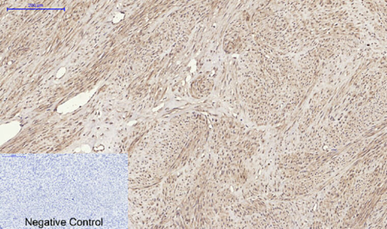 Fig.2. Immunohistochemical analysis of paraffin-embedded human uterus tissue. 1, RANKL Polyclonal Antibody was diluted at 1:200 (4°C, overnight). 2, Sodium citrate pH 6.0 was used for antibody retrieval (>98°C, 20min). 3, secondary antibody was diluted at 1:200 (room temperature, 30min). Negative control was used by secondary antibody only.