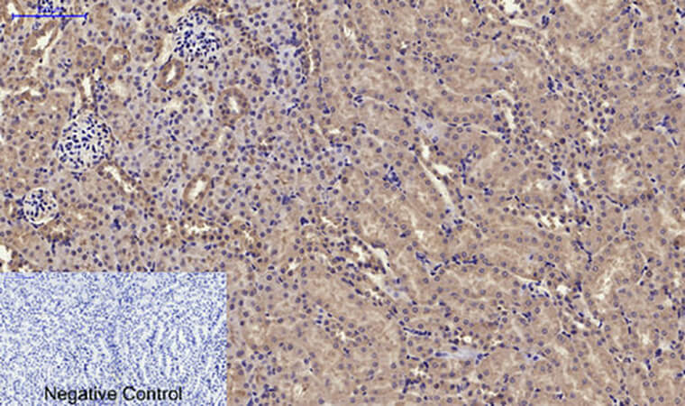 Fig.3. Immunohistochemical analysis of paraffin-embedded mouse kidney tissue. 1, RANKL Polyclonal Antibody was diluted at 1:200 (4°C, overnight). 2, Sodium citrate pH 6.0 was used for antibody retrieval (>98°C, 20min). 3, secondary antibody was diluted at 1:200 (room temperature, 30min). Negative control was used by secondary antibody only.