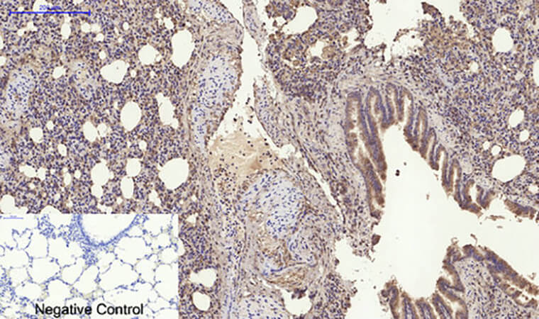Fig.4. Immunohistochemical analysis of paraffin-embedded rat lung tissue. 1, RANKL Polyclonal Antibody was diluted at 1:200 (4°C, overnight). 2, Sodium citrate pH 6.0 was used for antibody retrieval (>98°C, 20min). 3, secondary antibody was diluted at 1:200 (room temperature, 30min). Negative control was used by secondary antibody only.