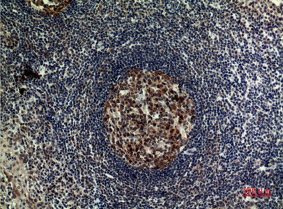 Fig.2. Immunohistochemical analysis of paraffin-embedded human-tonsilla, antibody was diluted at 1:100.