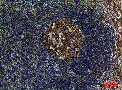 Fig.3. Immunohistochemical analysis of paraffin-embedded human-tonsilla, antibody was diluted at 1:100.