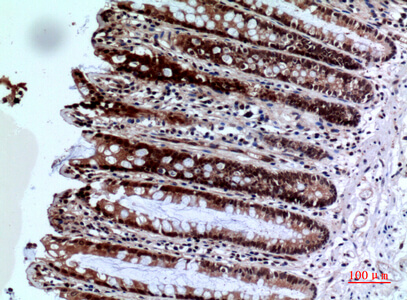 Fig.4. Immunohistochemical analysis of paraffin-embedded human-colon, antibody was diluted at 1:100.