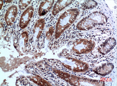Fig.5. Immunohistochemical analysis of paraffin-embedded human-colon, antibody was diluted at 1:100.