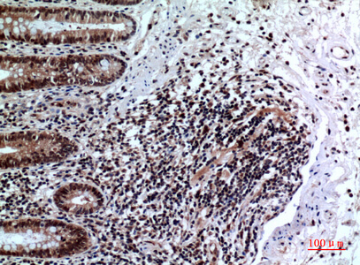 Fig.6. Immunohistochemical analysis of paraffin-embedded human-colon, antibody was diluted at 1:100.