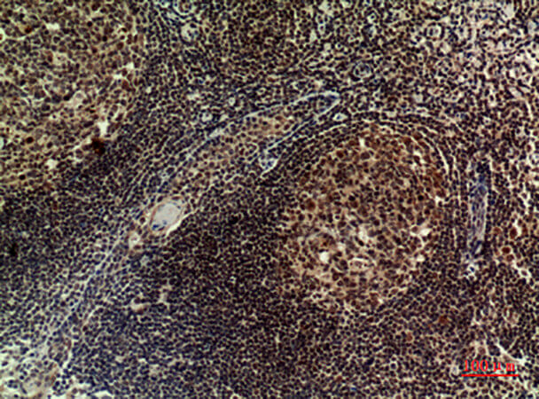 Fig.2. Immunohistochemical analysis of paraffin-embedded human tonsilla, antibody was diluted at 1:100.