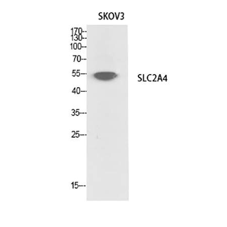 Fig.1. Western Blot analysis of SKOV3 cells using Glut4 Polyclonal Antibody.