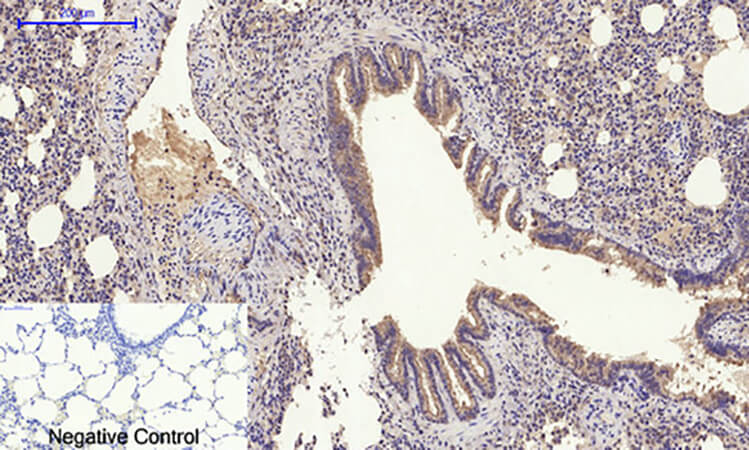 Fig.3. Immunohistochemical analysis of paraffin-embedded rat lung tissue. 1, Glut4 Polyclonal Antibody was diluted at 1:200 (4°C, overnight). 2, Sodium citrate pH 6.0 was used for antibody retrieval (>98°C, 20min). 3, secondary antibody was diluted at 1:200 (room temperature, 30min). Negative control was used by secondary antibody only.