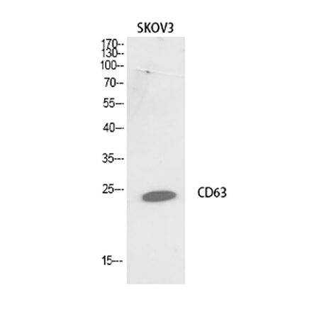 Fig.1. Western Blot analysis of SKOV3 cells using CD63 Polyclonal Antibody.